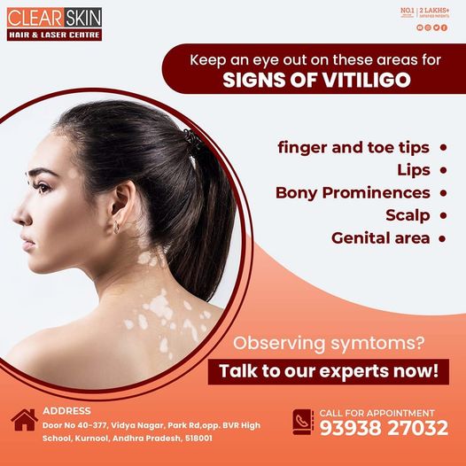 Fotos de clear skin in kurnool