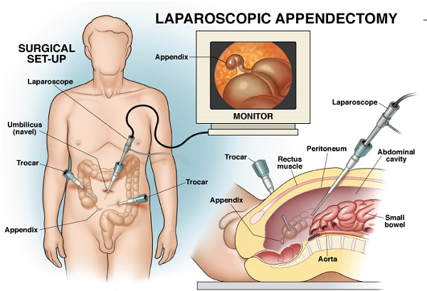 Foto de Best Surgical Gastroenterologist in Hyderabad | Laparoscopic Surgeon | Hernia Specialist & Surgeon | Liver Specialist |  Piles laser treatment in Hyderabad | Dr. Datta Ram U Hyderabad