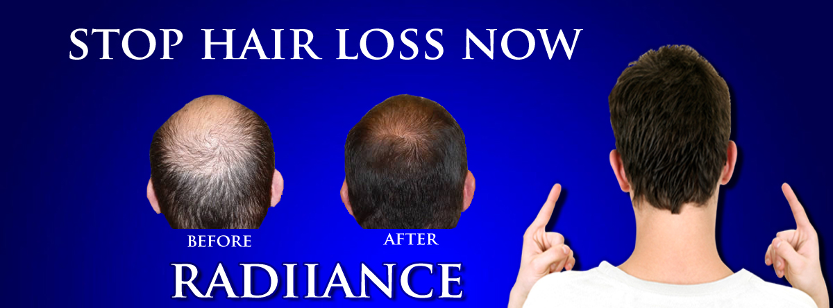 Foto de Radiance Advanced Hair Transplant Center